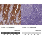 Anti-DHRS11 Antibody
