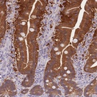 Immunohistochemical staining of human duodenum shows high expression.