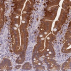 Anti-DHRS11 Antibody