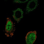 Immunofluorescent staining of human cell line PC-3 shows localization to nucleoplasm & cytosol.