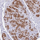 Anti-MVD Antibody