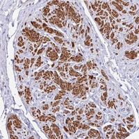 Anti-MVD Antibody