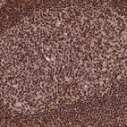 Anti-EXOSC9 Antibody