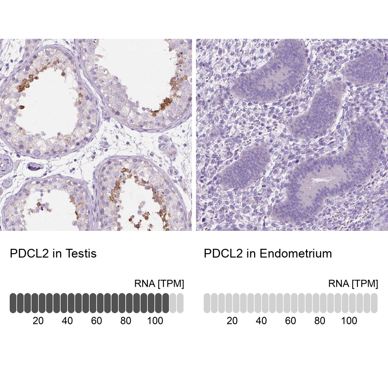 Anti-PDCL2 Antibody