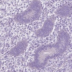 Immunohistochemical staining of human endometrium shows low expression as expected.
