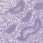 Anti-PDCL2 Antibody