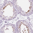 Immunohistochemical staining of human testis shows high expression.