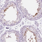 Anti-PDCL2 Antibody