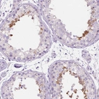 Immunohistochemical staining of human testis shows high expression.