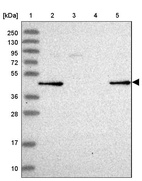 Lane 1: Marker [kDa] 250, 130, 95, 72, 55, 36, 28, 17, 10_br/_Lane 2: Human cell line RT-4_br/_Lane 3: Human cell line U-251MG sp_br/_Lane 4: Human plasma (IgG/HSA depleted)_br/_Lane 5: Human liver tissue