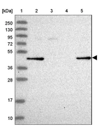 Lane 1: Marker [kDa] 250, 130, 95, 72, 55, 36, 28, 17, 10_br/_Lane 2: Human cell line RT-4_br/_Lane 3: Human cell line U-251MG sp_br/_Lane 4: Human plasma (IgG/HSA depleted)_br/_Lane 5: Human liver tissue