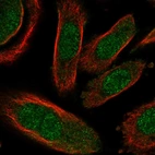 Immunofluorescent staining of human cell line PC-3 shows localization to nucleoplasm & cytosol.