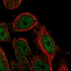 Immunofluorescent staining of human cell line PC-3 shows localization to nucleoplasm.