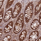 Anti-GGA1 Antibody