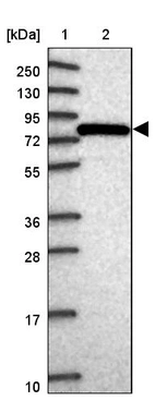 Lane 1: Marker [kDa] 250, 130, 95, 72, 55, 36, 28, 17, 10_br/_Lane 2: Human cell line RT-4