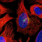 Immunofluorescent staining of human cell line U-2 OS shows localization to nucleoplasm & vesicles.
