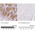 Anti-LYZ Antibody