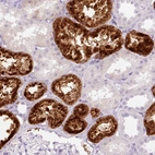 Immunohistochemical staining of human kidney shows strong extracellular positivity in cells in tubules.