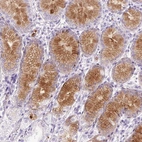Immunohistochemical staining of human stomach shows moderate extracellular positivity in glandular cells.