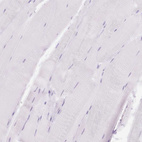 Immunohistochemical staining of human skeletal muscle shows no positivity in myocytes as expected.