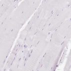 Immunohistochemical staining of human skeletal muscle shows no positivity in myocytes as expected.
