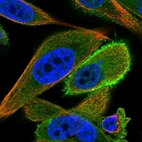 Immunofluorescent staining of human cell line PC-3 shows localization to plasma membrane & cytosol.