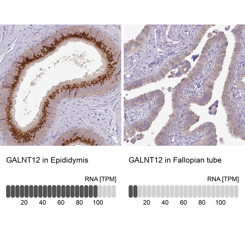 Anti-GALNT12 Antibody