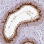Immunohistochemical staining of human epididymis shows high expression.