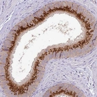 Immunohistochemical staining of human epididymis shows high expression.