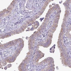 Immunohistochemical staining of human fallopian tube shows low expression as expected.