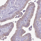 Immunohistochemical staining of human fallopian tube shows low expression as expected.