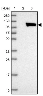 Lane 1: Marker [kDa] 250, 130, 95, 72, 55, 36, 28, 17, 10_br/_Lane 2: Human cell line RT-4_br/_Lane 3: Human cell line U-251MG sp