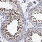 Anti-PTPN20 Antibody
