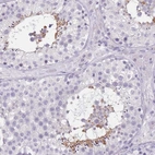 Anti-TCP11 Antibody