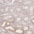 Anti-ZNF852 Antibody