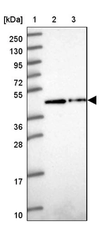 Lane 1: Marker [kDa] 250, 130, 95, 72, 55, 36, 28, 17, 10_br/_Lane 2: Human cell line RT-4_br/_Lane 3: Human cell line U-251MG sp