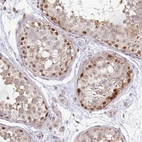 Anti-MAZ Antibody