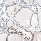 Immunohistochemical staining of human thyroid gland shows moderate nuclear positivity in glandular cells.