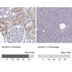 Anti-ACAD11 Antibody