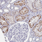 Anti-ACAD11 Antibody