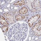 Immunohistochemical staining of human kidney shows moderate granular cytoplasmic positivity in cells in tubules.