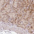 Immunohistochemical staining of human stomach shows moderate nuclear positivity in glandular cells.