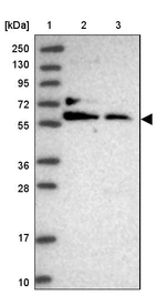 Lane 1: Marker [kDa] 250, 130, 95, 72, 55, 36, 28, 17, 10_br/_Lane 2: Human cell line RT-4_br/_Lane 3: Human cell line U-251MG sp