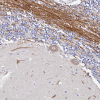 Anti-ACAD11 Antibody