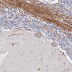 Immunohistochemical staining of human cerebellum shows moderate granular cytoplasmic positivity in Purkinje cells.