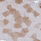 Anti-ACAD11 Antibody