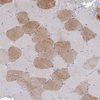 Immunohistochemical staining of human skeletal muscle shows moderate granular cytoplasmic positivity in myocytes.