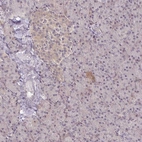 Anti-PRKCB Antibody
