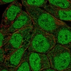 Immunofluorescent staining of human cell line RT4 shows localization to nucleoplasm & cytosol.