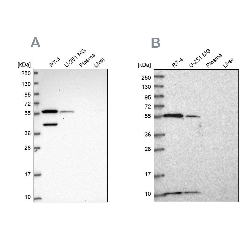 Anti-NUP50 Antibody